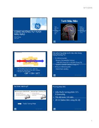 Bài thuyết trình Cộng hưởng từ tưới máu não