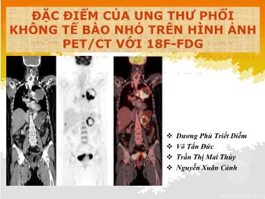 Bài thuyết trình Đặc điểm của ung thư phổi không tế bào nhỏ trên hình ảnh PET/CT với 18F-FDG - Dương Phủ Triết Diễm