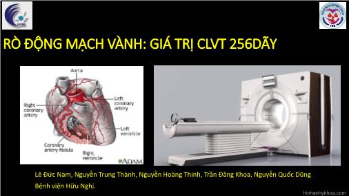 Bài thuyết trình Rò động mạch vành: Giá trị CLVT 256 dãy - Lê Đức Nam