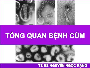 Bài thuyết trình Tổng quan bệnh cúm - Nguyễn Ngọc Rạng